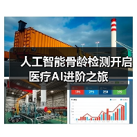 人工智能骨龄检测开启医疗AI进阶之旅（图1）