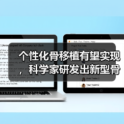 个性化骨移植有望实现,科学家研发出新型骨骼工程技术(图1) 个性化骨移植有望实现,科学家研发出新型骨骼工程技术(图1)