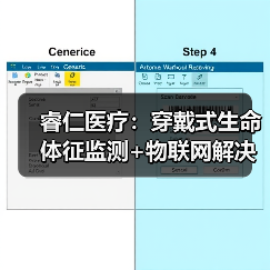 睿仁医疗:穿戴式生命体征监测+物联网解决方案,打通家庭监测与院内服务(图3) 睿仁医疗:穿戴式生命体征监测+物联网解决方案,打通家庭监测与院内服务(图3)