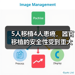 5人移植4人患癌,器官移植的安全性受到重大考验(图2) 5人移植4人患癌,器官移植的安全性受到重大考验(图2)