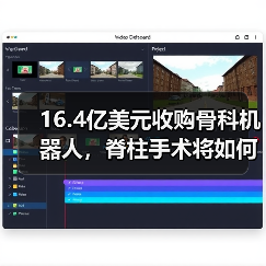 16.4亿美元收购骨科机器人,脊柱手术将如何革新?(图1) 16.4亿美元收购骨科机器人,脊柱手术将如何革新?(图1)