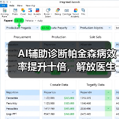 AI辅助诊断帕金森病效率提升十倍,解放医生负担(图1) AI辅助诊断帕金森病效率提升十倍,解放医生负担(图1)