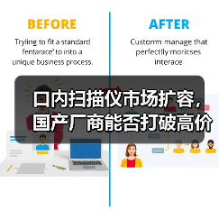 口内扫描仪市场扩容,国产厂商能否打破高价垄断(图2) 口内扫描仪市场扩容,国产厂商能否打破高价垄断(图2)