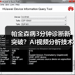 帕金森病3分钟诊断新突破?AI视频分析技术解析(图4) 帕金森病3分钟诊断新突破?AI视频分析技术解析(图4)