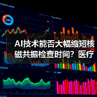 AI技术能否大幅缩短核磁共振检查时间?医疗行业迎来新机遇(图2) AI技术能否大幅缩短核磁共振检查时间?医疗行业迎来新机遇(图2)