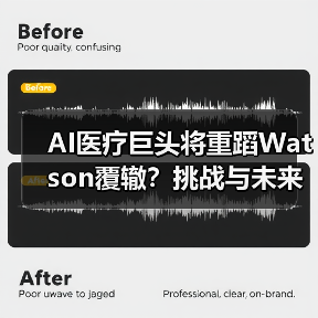 AI医疗巨头将重蹈Watson覆辙?挑战与未来展望(图1) AI医疗巨头将重蹈Watson覆辙?挑战与未来展望(图1)